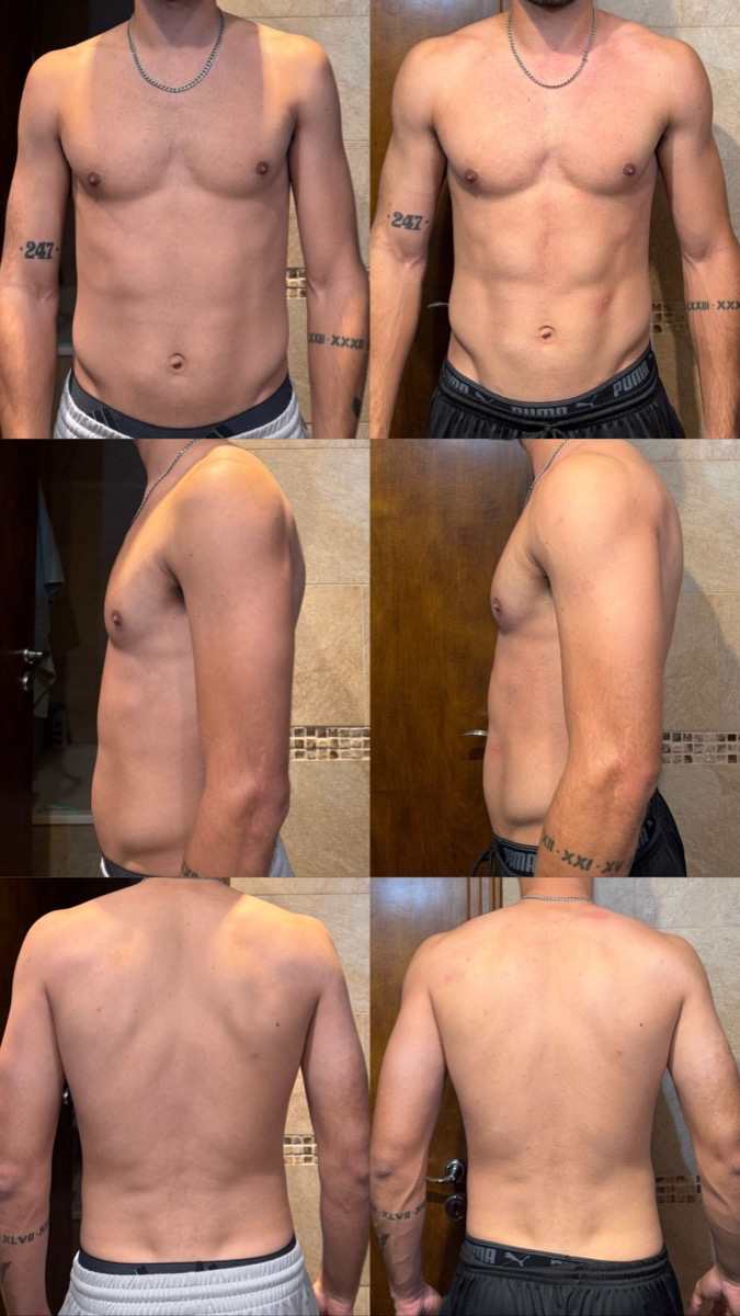 Resultado cliente 1 — antes y después con el método TP 360