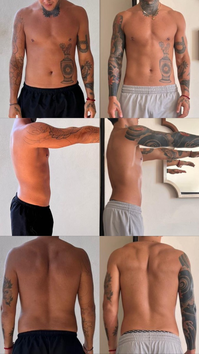 Resultado cliente 2 — antes y después con el método TP 360