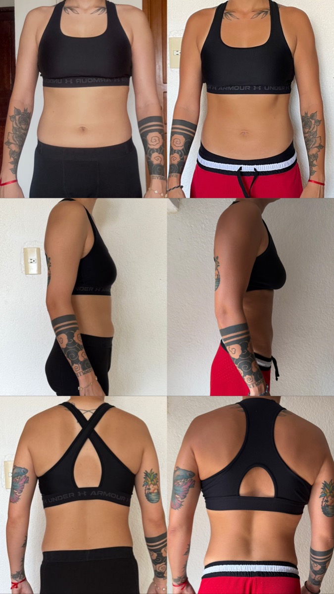 Resultado cliente 7 — antes y después con el método TP 360